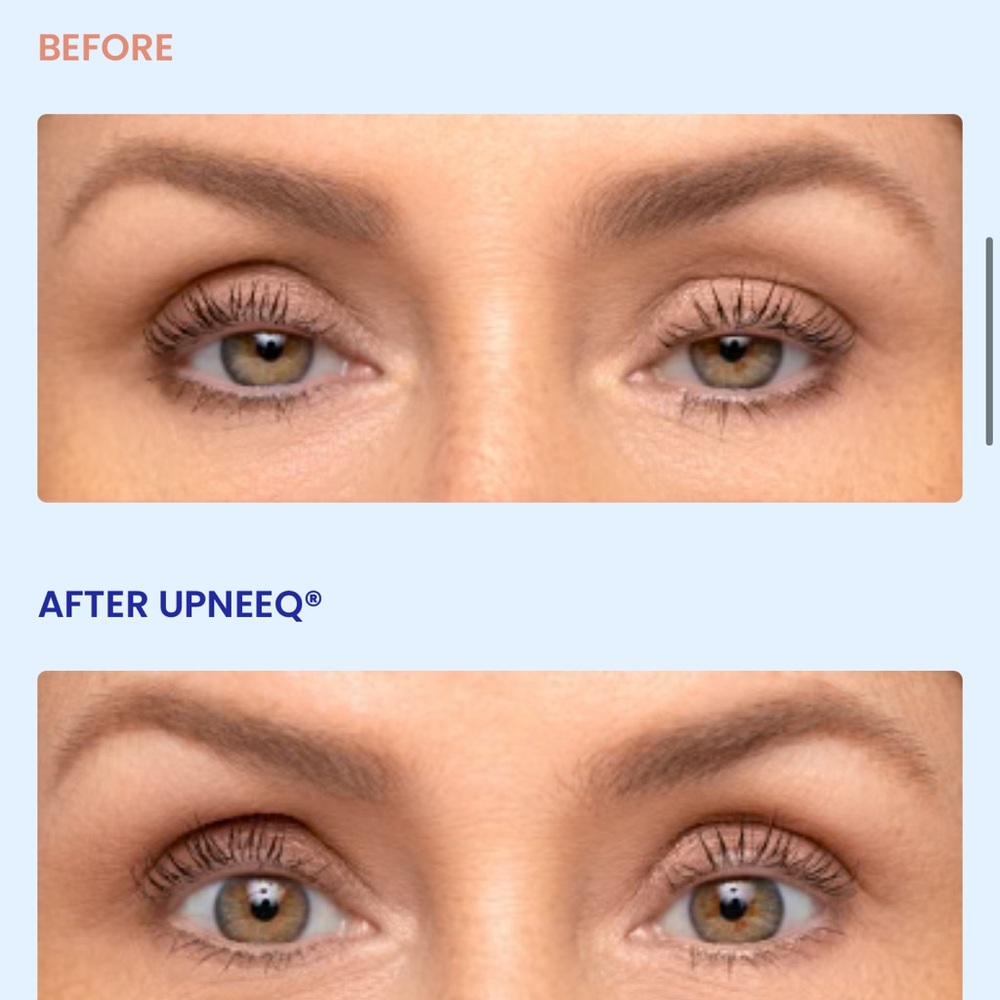 UPNEEQ Eye Drops - set of 2 - Picture 2 of 7